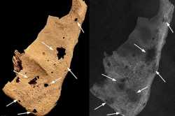3,200-Year-Old Skeleton is Oldest Known Case of Human Cancer